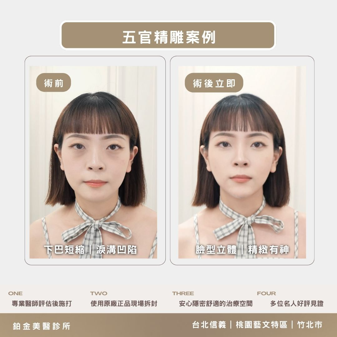鉑金排版封面 – 12